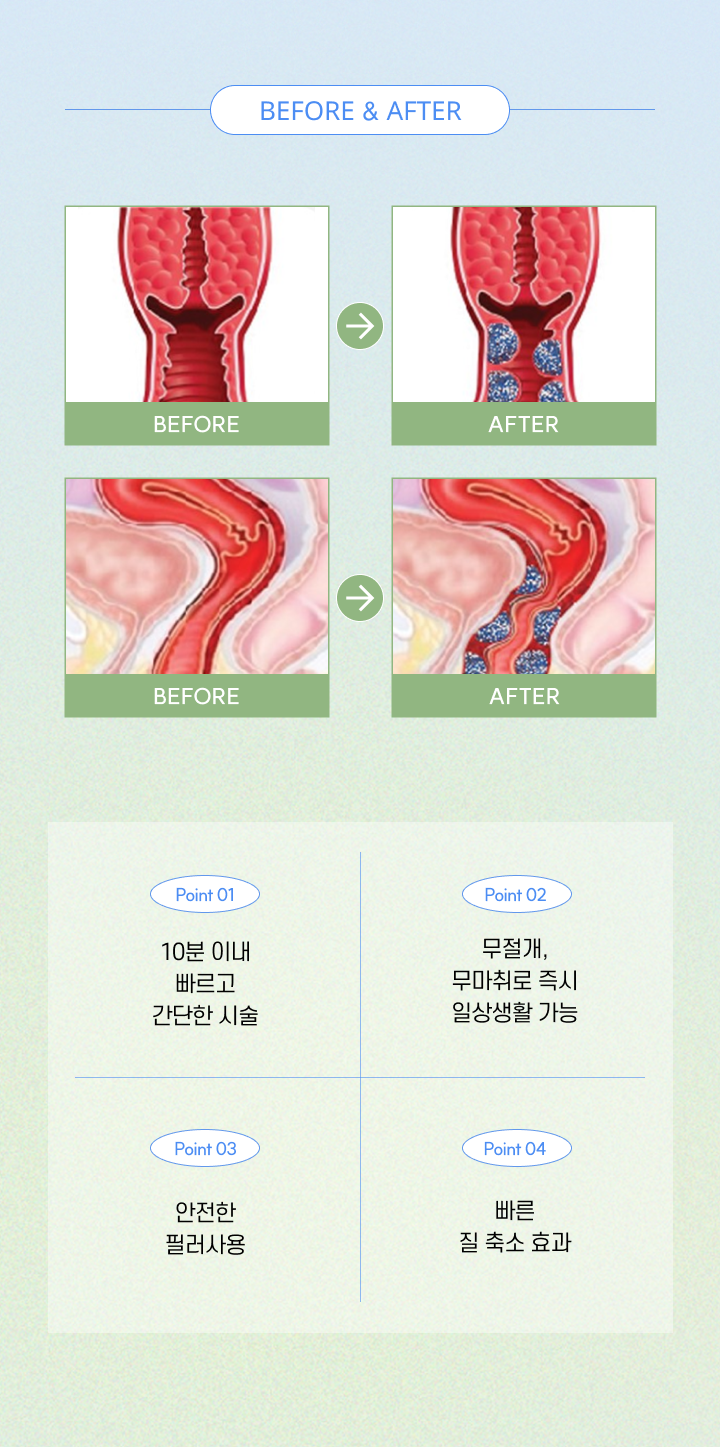 before & after